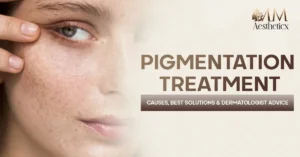 Pigmentation Treatment in Delhi